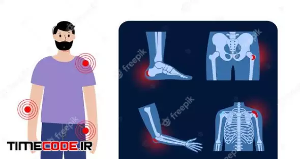 Common Types Of Bursitis. Inflamed Bursa In Human Body. Elbow, Shoulder, Knee Pain 