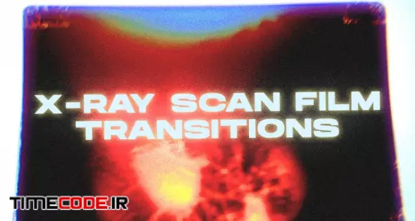 X-ray Scan Film Transitions