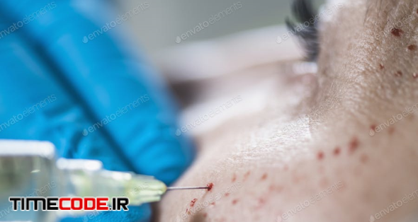 PRP Face Cosmetics Injecting. Cosmetic Anti-Aging Face Treatment